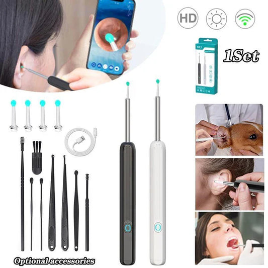 Vivenza ™Smart Ear Cleaning Device