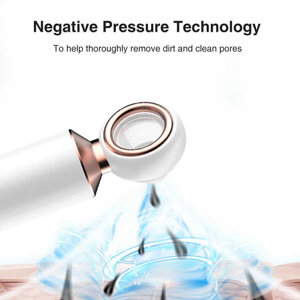 𝙑𝙞𝙫𝙚𝙣𝙯𝙖™ Blackhead Suction Machine