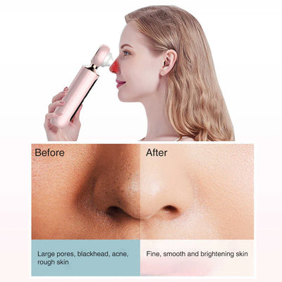 𝙑𝙞𝙫𝙚𝙣𝙯𝙖™ Blackhead Suction Machine