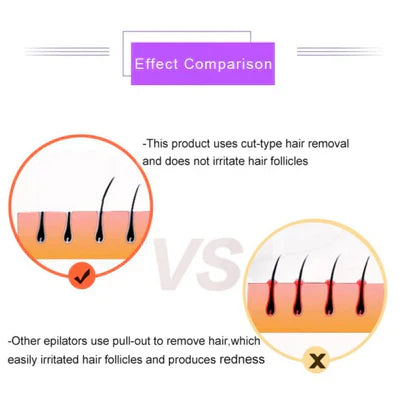 𝙑𝙞𝙫𝙚𝙣𝙯𝙖™Purple Epilator – آلة إزالة الشعر البنفسجية