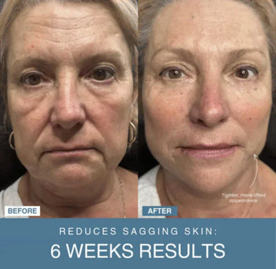 𝙑𝙞𝙫𝙚𝙣𝙯𝙖™ 7-in-1 LED Anti-Aging & Wrinkle Apparatus | جهاز 𝙑𝙞𝙫𝙚𝙣𝙯𝙖™ 7 في 1 لعلاج التجاعيد ومكافحة الشيخوخة بالليد