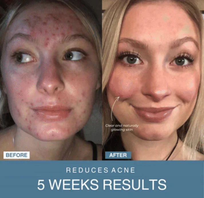 𝙑𝙞𝙫𝙚𝙣𝙯𝙖™ 7-in-1 LED Anti-Aging & Wrinkle Apparatus | جهاز 𝙑𝙞𝙫𝙚𝙣𝙯𝙖™ 7 في 1 لعلاج التجاعيد ومكافحة الشيخوخة بالليد
