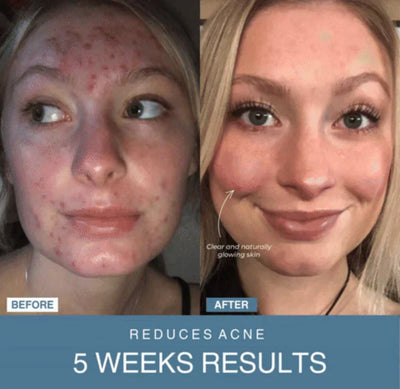 𝙑𝙞𝙫𝙚𝙣𝙯𝙖™ 7-in-1 LED Anti-Aging & Wrinkle Apparatus | جهاز 𝙑𝙞𝙫𝙚𝙣𝙯𝙖™ 7 في 1 لعلاج التجاعيد ومكافحة الشيخوخة بالليد