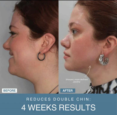 𝙑𝙞𝙫𝙚𝙣𝙯𝙖™ 7-in-1 LED Anti-Aging & Wrinkle Apparatus | جهاز 𝙑𝙞𝙫𝙚𝙣𝙯𝙖™ 7 في 1 لعلاج التجاعيد ومكافحة الشيخوخة بالليد