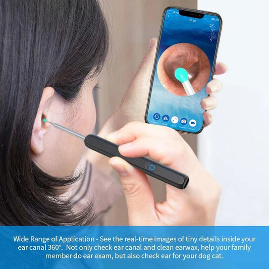Vivenza ™Smart Ear Cleaning Device